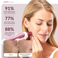 PMD Personal Microderm Classic